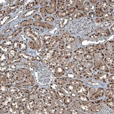 Immunohistochemistry-Paraffin: MAT2A Antibody [NBP1-92100]