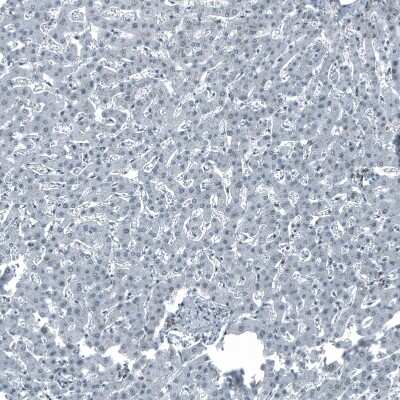Immunohistochemistry-Paraffin: MAT2A Antibody [NBP1-92100]