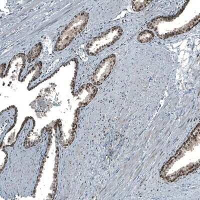 Immunohistochemistry-Paraffin: MAT2A Antibody [NBP1-92100]