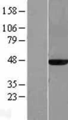 Western Blot: MAT2A Overexpression Lysate [NBL1-12910]