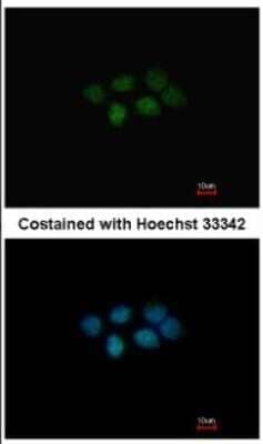 Immunocytochemistry/ Immunofluorescence: MAT2B Antibody [NBP2-17230]