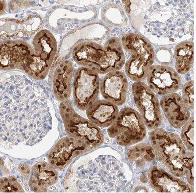 Immunohistochemistry-Paraffin: MAT2B Antibody [NBP1-82797]