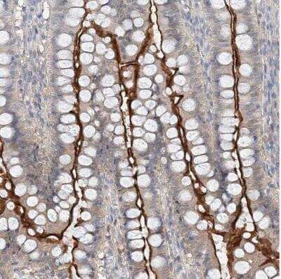 Immunohistochemistry-Paraffin: MAT2B Antibody [NBP1-82797]