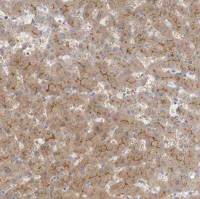Immunohistochemistry-Paraffin: MAT2B Antibody [NBP1-82797]