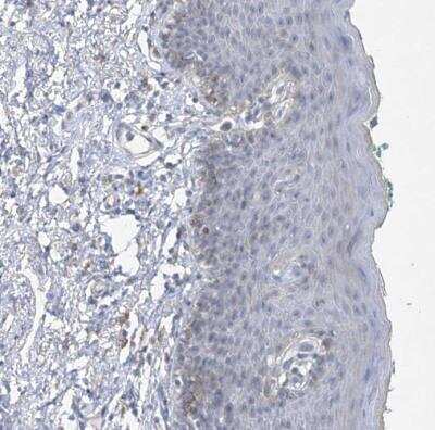 Immunohistochemistry-Paraffin: MAT2B Antibody [NBP1-82797]