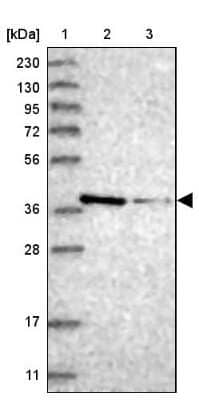 Western Blot: MAT2B Antibody [NBP1-82797]