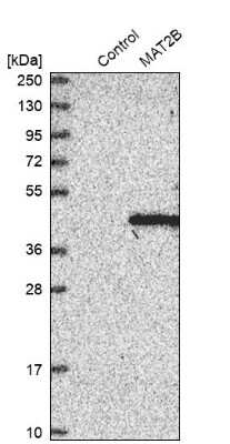 Western Blot: MAT2B Antibody [NBP1-82798]