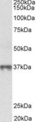 Western Blot: MAT2B Antibody [NBP2-26144]