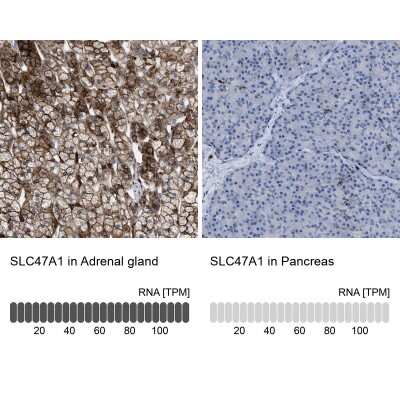 Immunohistochemistry-Paraffin: MATE1 Antibody [NBP1-87909]