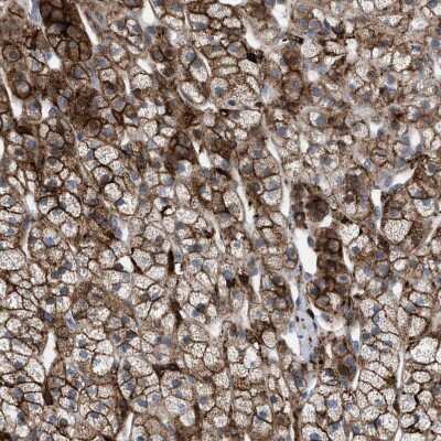 Immunohistochemistry-Paraffin: MATE1 Antibody [NBP1-87909]