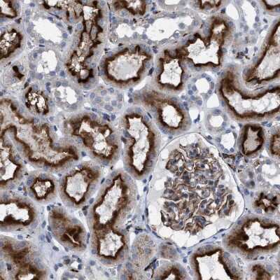 Immunohistochemistry-Paraffin: MATE1 Antibody [NBP1-87909]