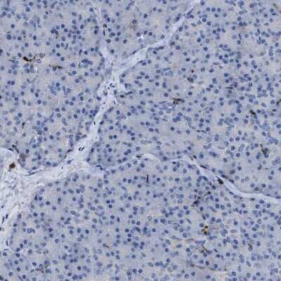 Immunohistochemistry-Paraffin: MATE1 Antibody [NBP1-87909]