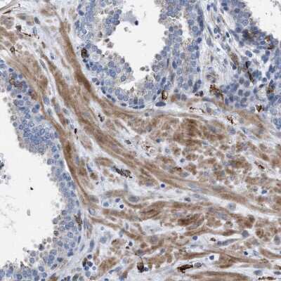 Immunohistochemistry-Paraffin: MATE1 Antibody [NBP1-87909]
