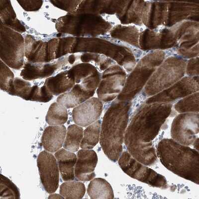 Immunohistochemistry-Paraffin: MATE1 Antibody [NBP1-87909]