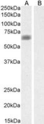 Western Blot: MATE1 Antibody [NBP1-36989]