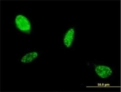 Immunocytochemistry/ Immunofluorescence: MATH1 Antibody (1B12) [H00000474-M01]