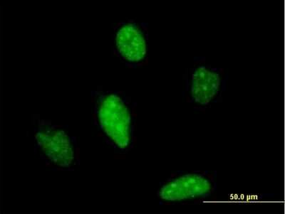 Immunocytochemistry/ Immunofluorescence: MATH1 Antibody (1C5) [H00000474-M04]