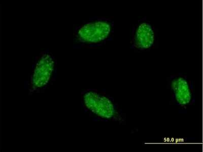 Immunocytochemistry/ Immunofluorescence: MATH1 Antibody (2G8) [H00000474-M07]