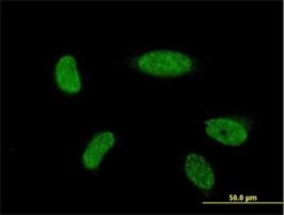 Immunocytochemistry/ Immunofluorescence: MATH1 Antibody (3B12) [H00000474-M06]