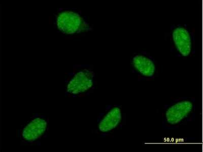 Immunocytochemistry/ Immunofluorescence: MATH1 Antibody (3E2) [H00000474-M05]