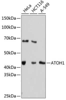 Western Blot: MATH1 Antibody (7N3G2) [NBP3-15387]