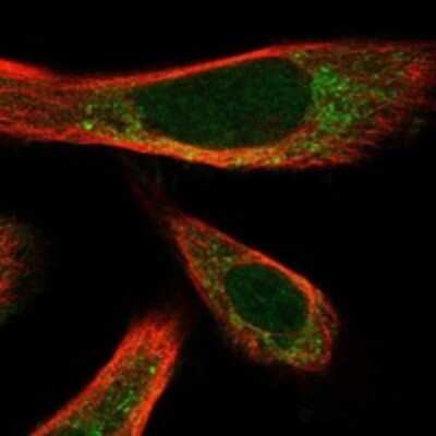 Immunocytochemistry/ Immunofluorescence: MATH1 Antibody [NBP3-17661]