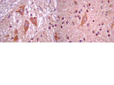 Immunohistochemistry: MATH2/NEUROD6 Antibody [NBP2-29865]
