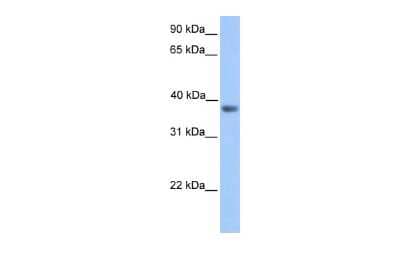 Western Blot: MATH2/NEUROD6 Antibody [NBP3-10938]