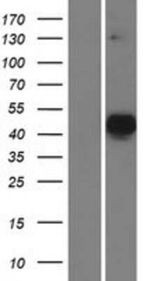 Western Blot: MATH2/NEUROD6 Overexpression Lysate [NBP2-06416]