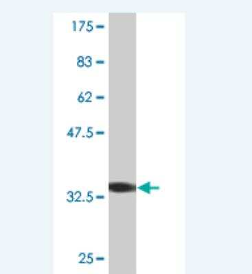 Western Blot: MATK Antibody (2C5) [H00004145-M05]