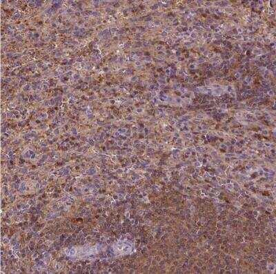 Immunohistochemistry-Paraffin: MATK Antibody [NBP1-84487]