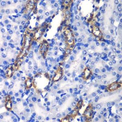 Immunohistochemistry-Paraffin: MATK Antibody - BSA Free [NBP3-04984]