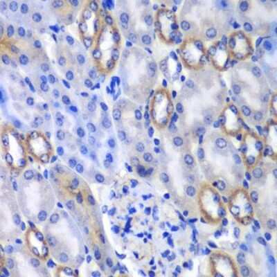 Immunohistochemistry-Paraffin: MATK Antibody - BSA Free [NBP3-04984]