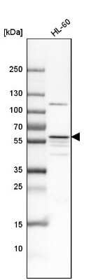 Western Blot: MATK Antibody [NBP1-84487]