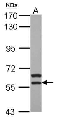 Western Blot: MATK Antibody [NBP2-17231]