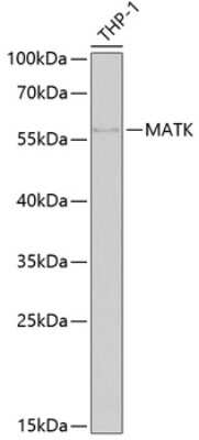 Western Blot: MATK AntibodyBSA Free [NBP3-04984]