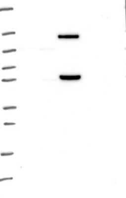 Western Blot: MATK Antibody [NBP3-17887]