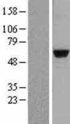 Western Blot: MATK Overexpression Lysate [NBL1-12914]