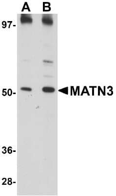 Western Blot: MATN3 AntibodyBSA Free [NBP1-77017]