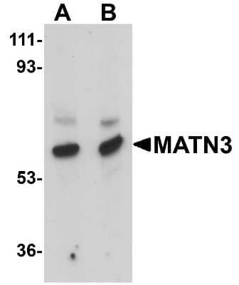 Western Blot: MATN3 AntibodyBSA Free [NBP1-77022]