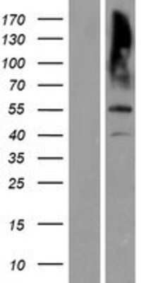 Western Blot: MATN3 Overexpression Lysate [NBP2-08119]