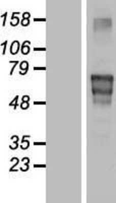 Western Blot: Matrilin-4 Overexpression Lysate [NBP2-07945]