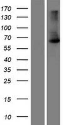 Western Blot: MAU2 Overexpression Lysate [NBP2-07191]