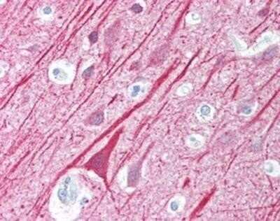 Immunohistochemistry-Paraffin: MAVS Antibody - BSA Free [NB100-80859]