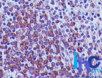 Immunohistochemistry: MAVS Antibody (58N3B6) - Azide and BSA Free [NBP2-80842]