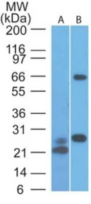 Western Blot: MAVS Antibody (58N3B6)BSA Free [NBP2-22380]