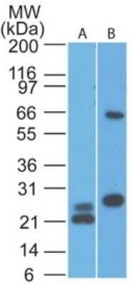 Western Blot: MAVS Antibody (58N3E1)Azide and BSA Free [NBP2-80840]