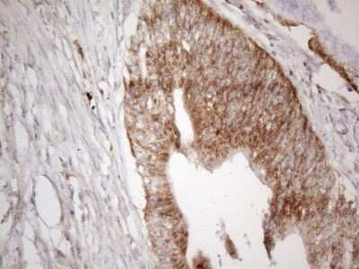 Immunohistochemistry: MAVS Antibody (OTI9C4) [NBP2-45757]