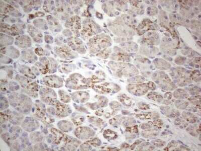Immunohistochemistry: MAVS Antibody (OTI9C4) [NBP2-45757]