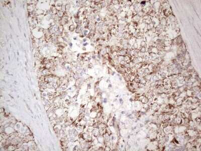 Immunohistochemistry: MAVS Antibody (OTI9C4) [NBP2-45757]